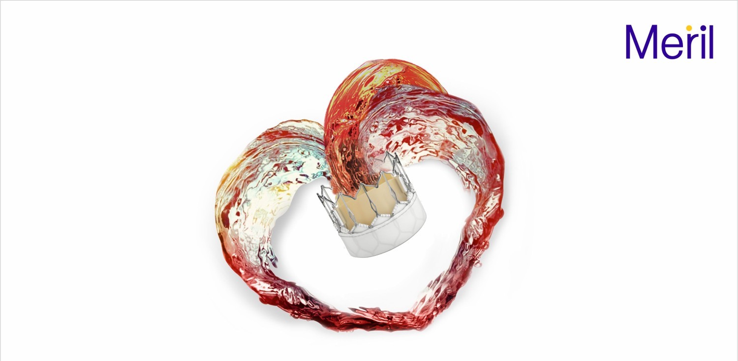 Medical Instruments sbarca nel mondo delle valvole TAVI